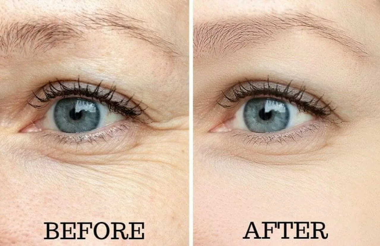 Osmotics Under Eye Rejuvenator, антивозрастной крем для глаз от темных кругов, мешков, морщин и отечности Osmotics Cosmeceuticals — фото 4