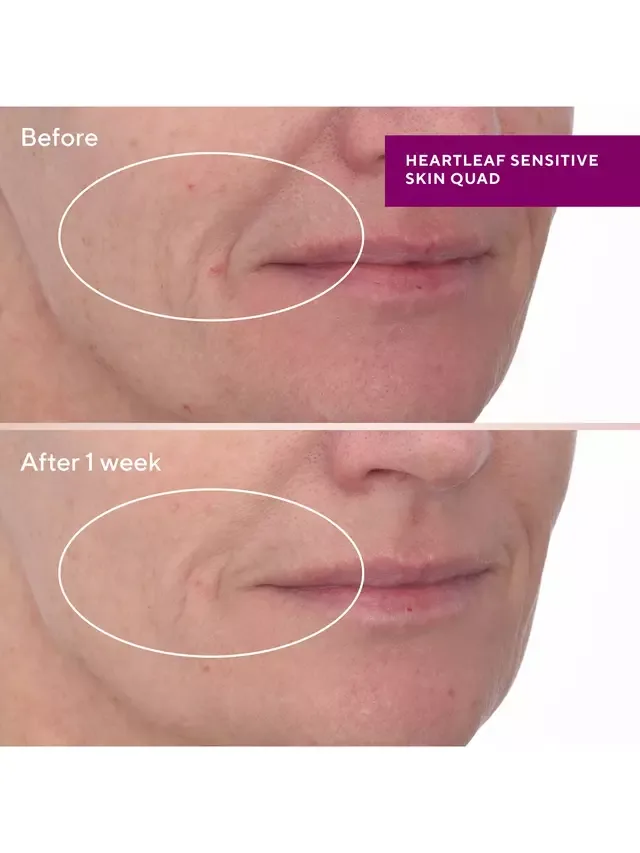Сыворотка Murad — Мягкая для обновления кожи Heartleaf, 30 мл — фото 3