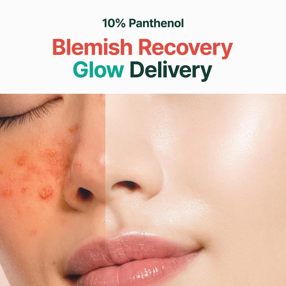 Крем для лица Purito — Увлажняющий «Panthenol % Post-Acne Cream» от, 100 мл — фото 3