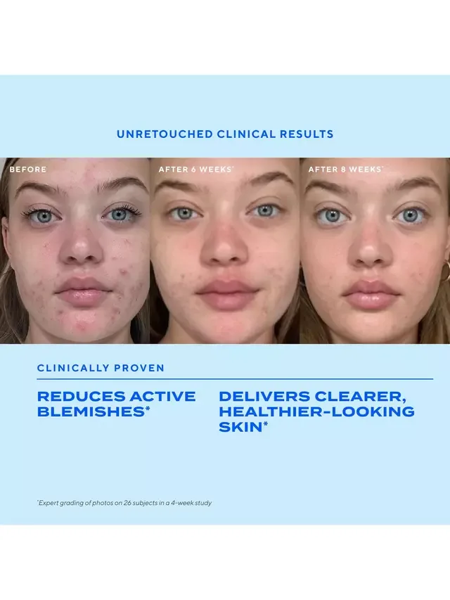 Сыворотка Murad — Для контроля и предотвращения появления прыщей Blemish Control Biome-Balancing Clear &, 30 мл — фото 3