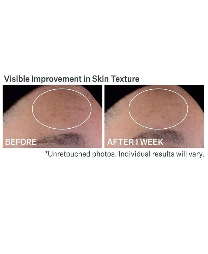 Advanced Retinol Ночная мультикорректирующая сыворотка Strivectin — фото 2