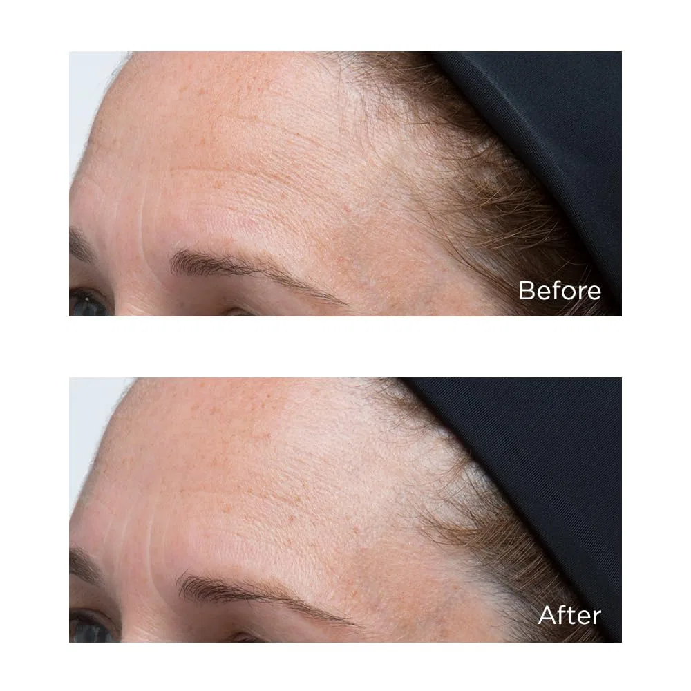Сыворотка Perricone Md — Интенсивный увлажняющий «High Potency Classics Hyaluronic Intensive Moisturiser» от, 30 мл — фото 4