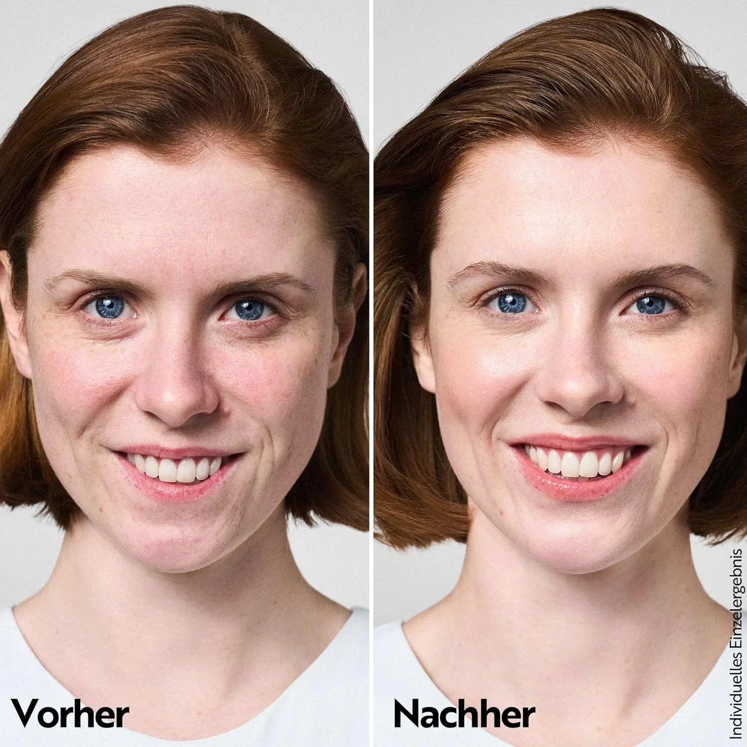 Сыворотка M. Asam — Для лица «Aqua Intense Barrier Repair» от, 30 мл — фото 3