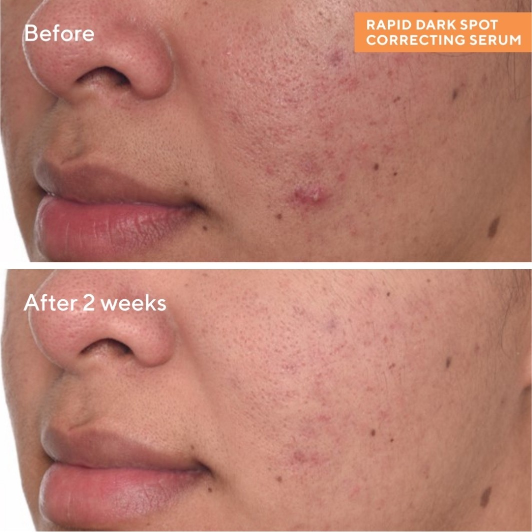 Сыворотка Murad — Для лица rapid dark spot correcting serum , объем, 30 мл — фото 3