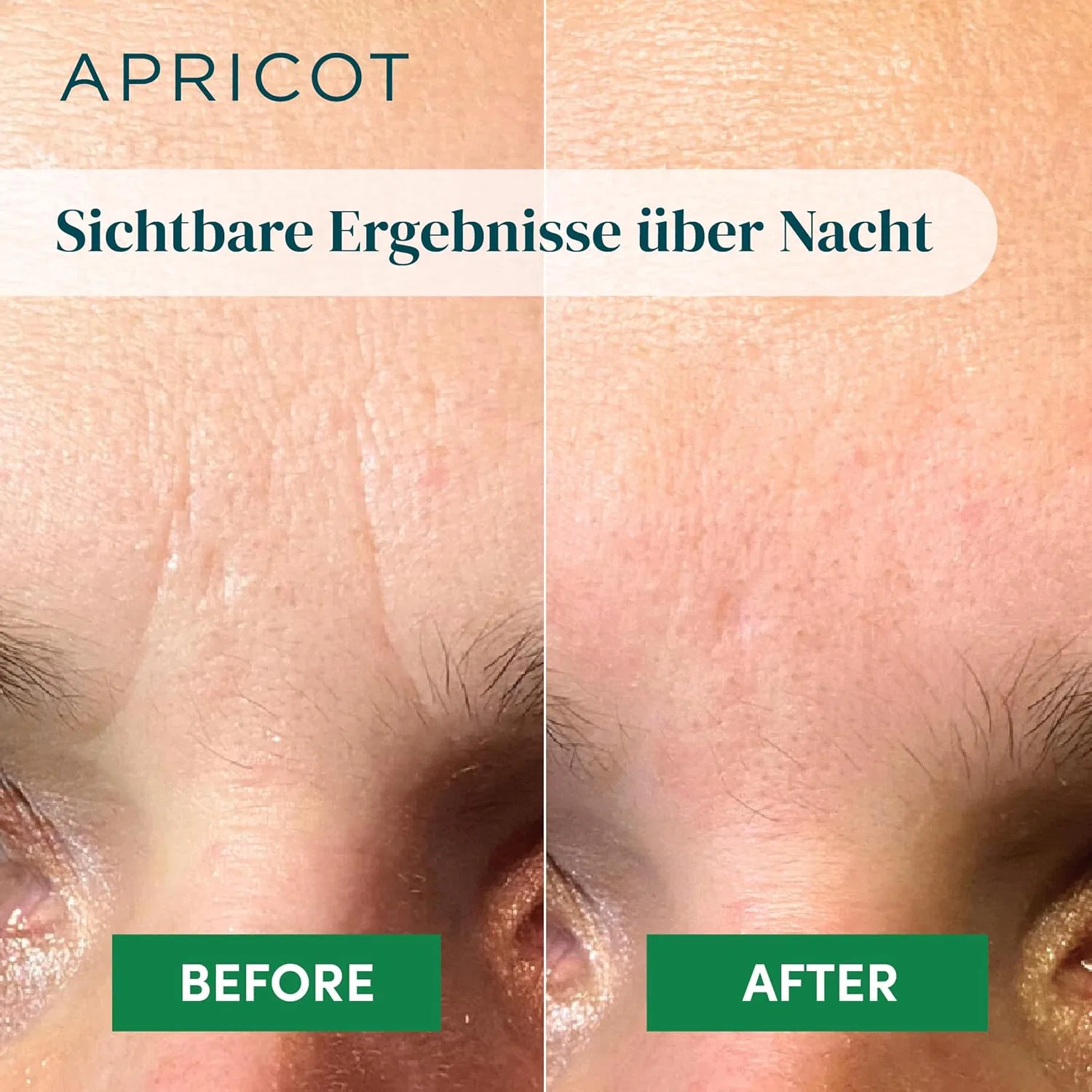Патчи от морщин Apricot с алоэ вера, 60 штук Apricot Beauty & Healthcare, Aloe Vera For Sensitive Or Dry Skin — фото 4
