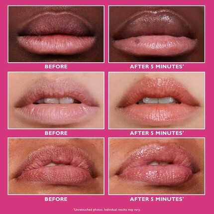 Instant FIRMx Lip Filler Уход за губами Увеличивает объем Клинически доказано, что он мгновенно улучшает внешний вид губ и разглаживает морщины Peter Thomas Roth — фото 3