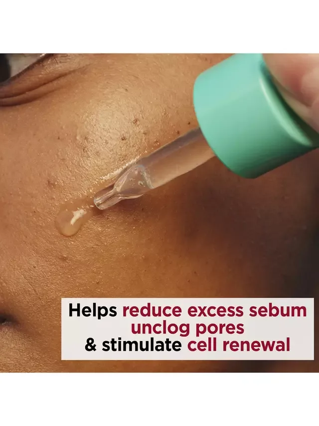 Сыворотка Clarins — Для лица My PURE-RESET Resurfacing Blemish Serum, 30 мл — фото 3