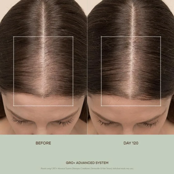 Vegamour GRO+ Advanced Hair Serum для увеличения густоты волос, уменьшения выпадения и баланса кожи головы, без отдушек, vegan, cruelty-free — фото 3