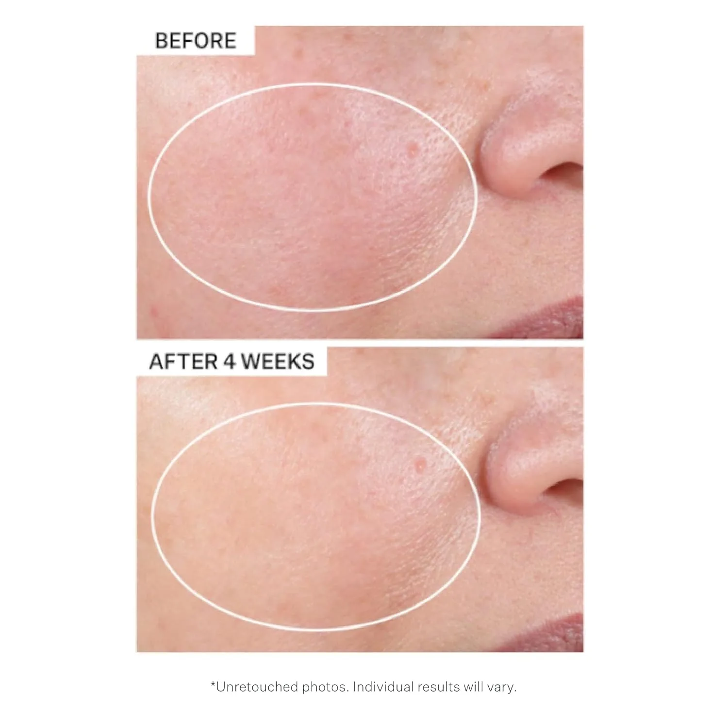 Крем для лица StriVectin — Advanced Retinol борется с видимыми признаками старения, делая кожу более здоровой — фото 4