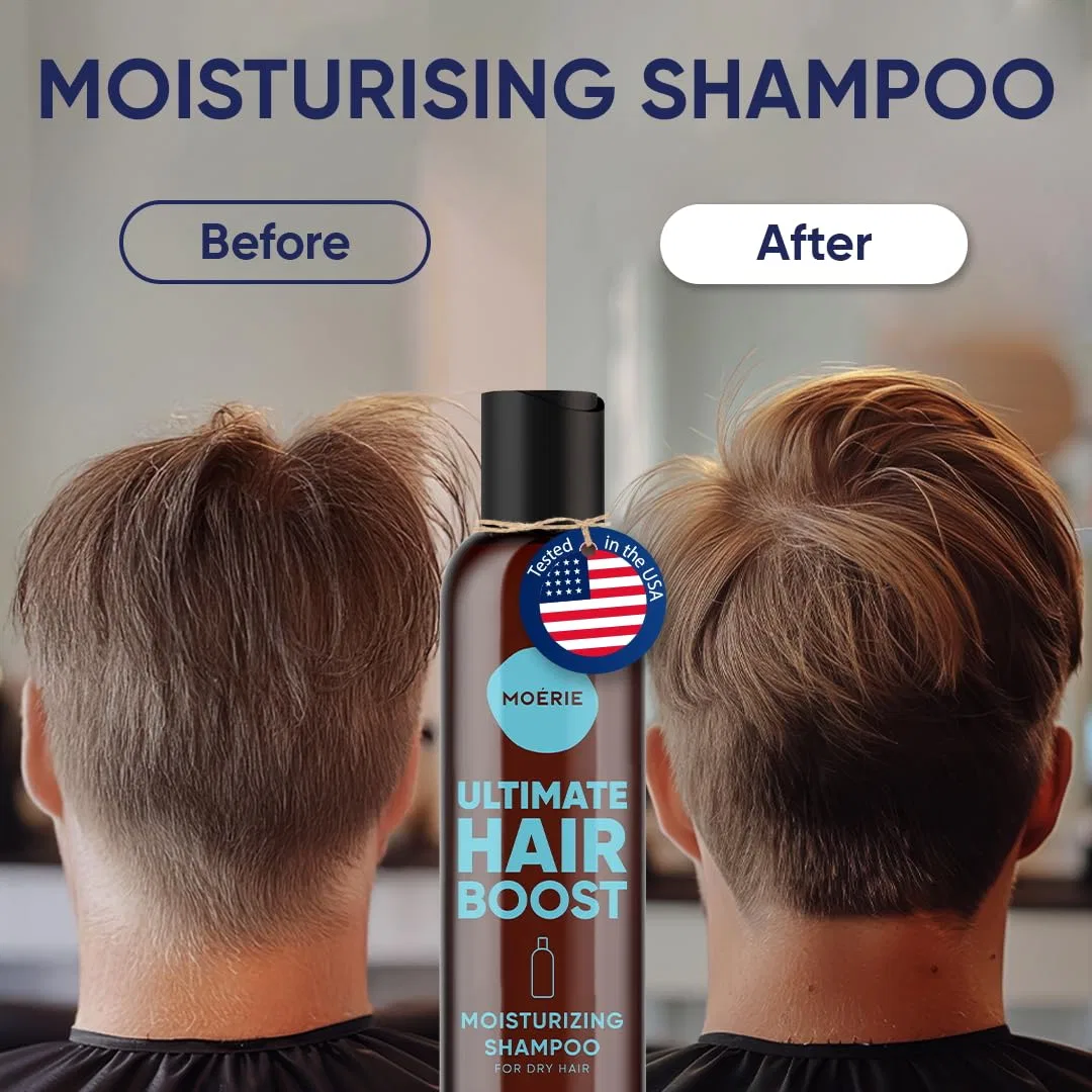 Шампунь для роста волос Moerie Ultimate Hair Growth Moerie, Single Set — фото 4