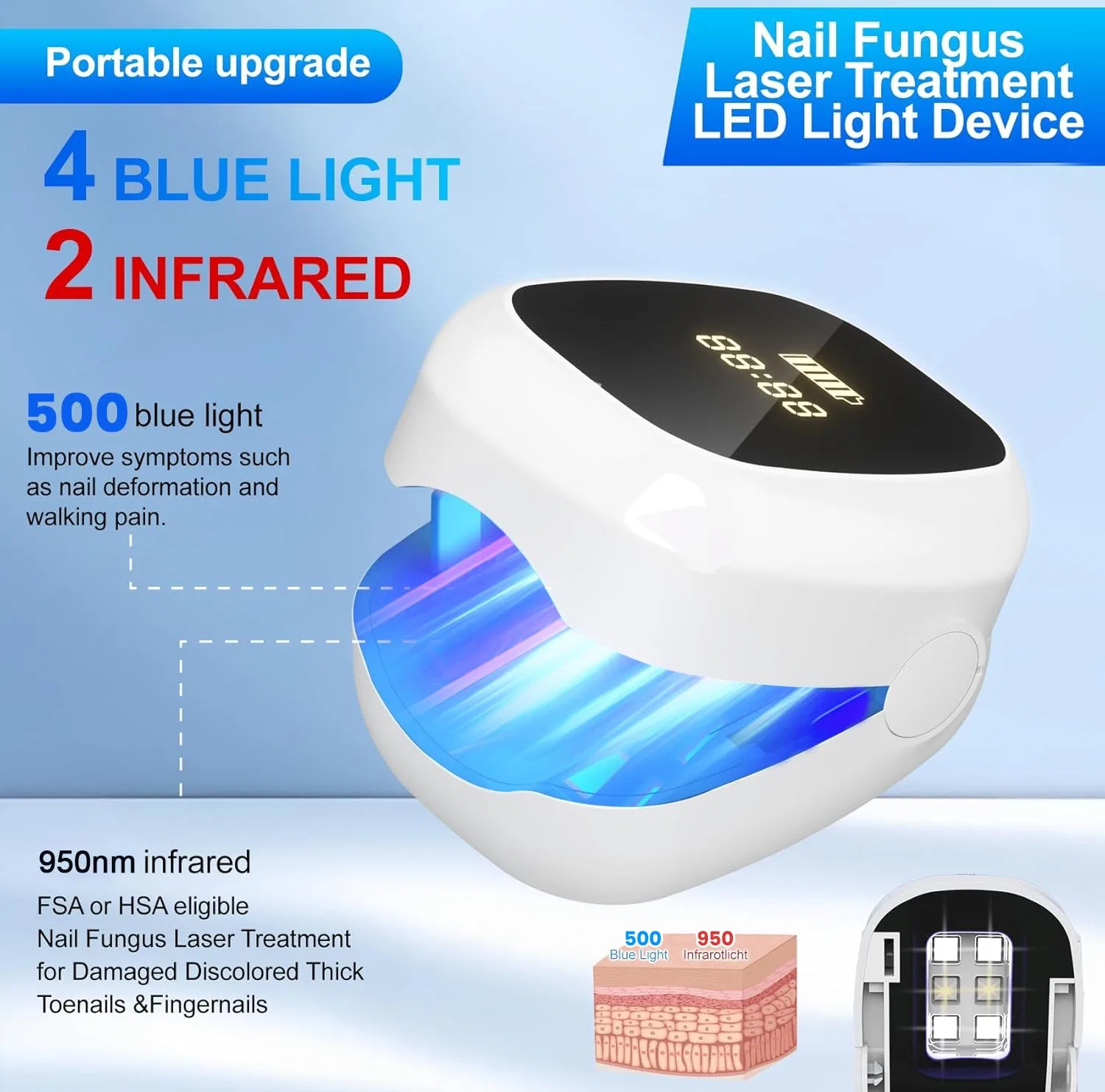 Лазерное устройство для лечения грибка ногтей «Upgrade» от Pipihome Pipihome, A — фото 2