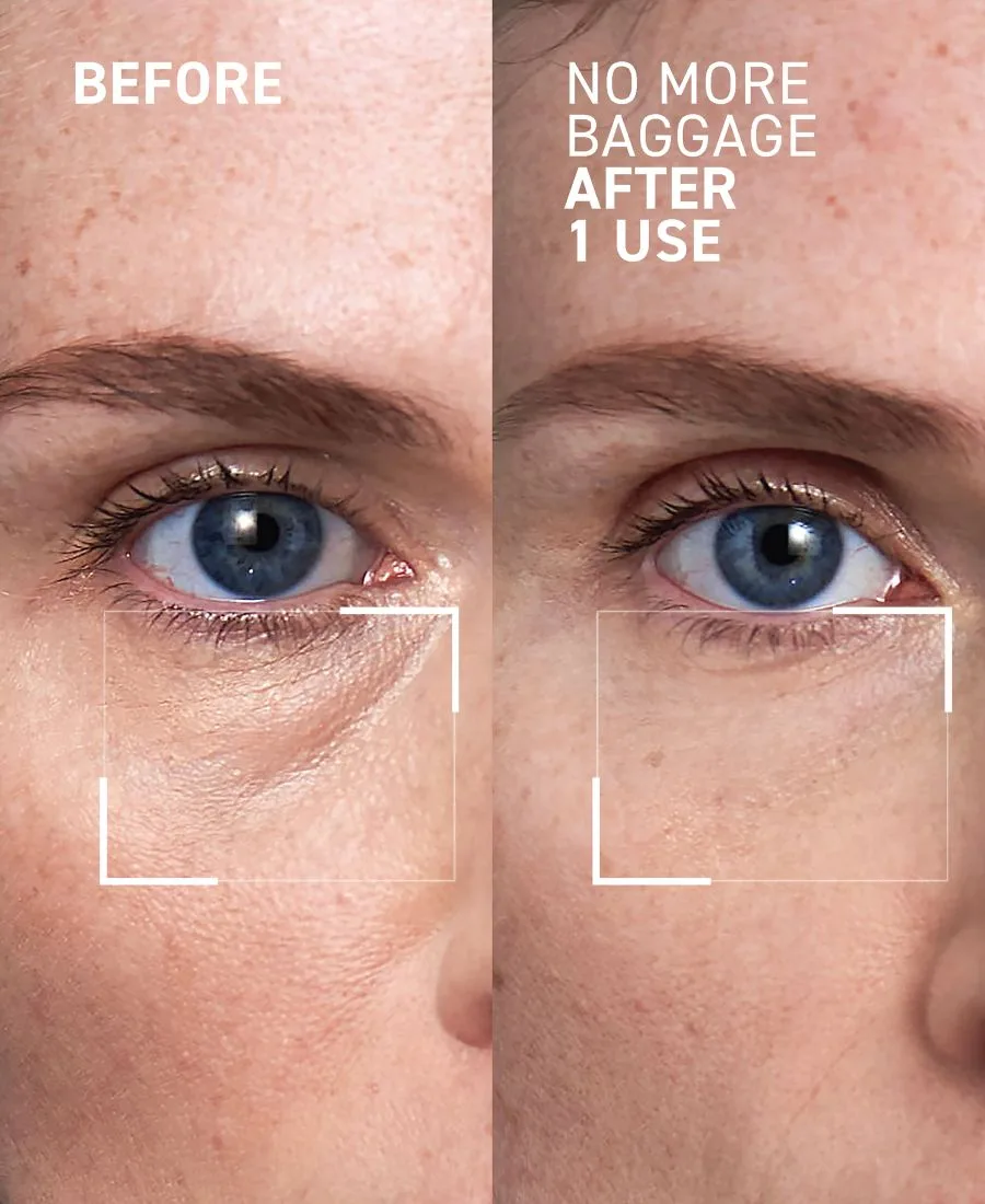 Крем для лица Dr. Brandt — Гель для снятия отечности под глазами No More Baggage Eye De-Puffing Gel, , None — фото 2