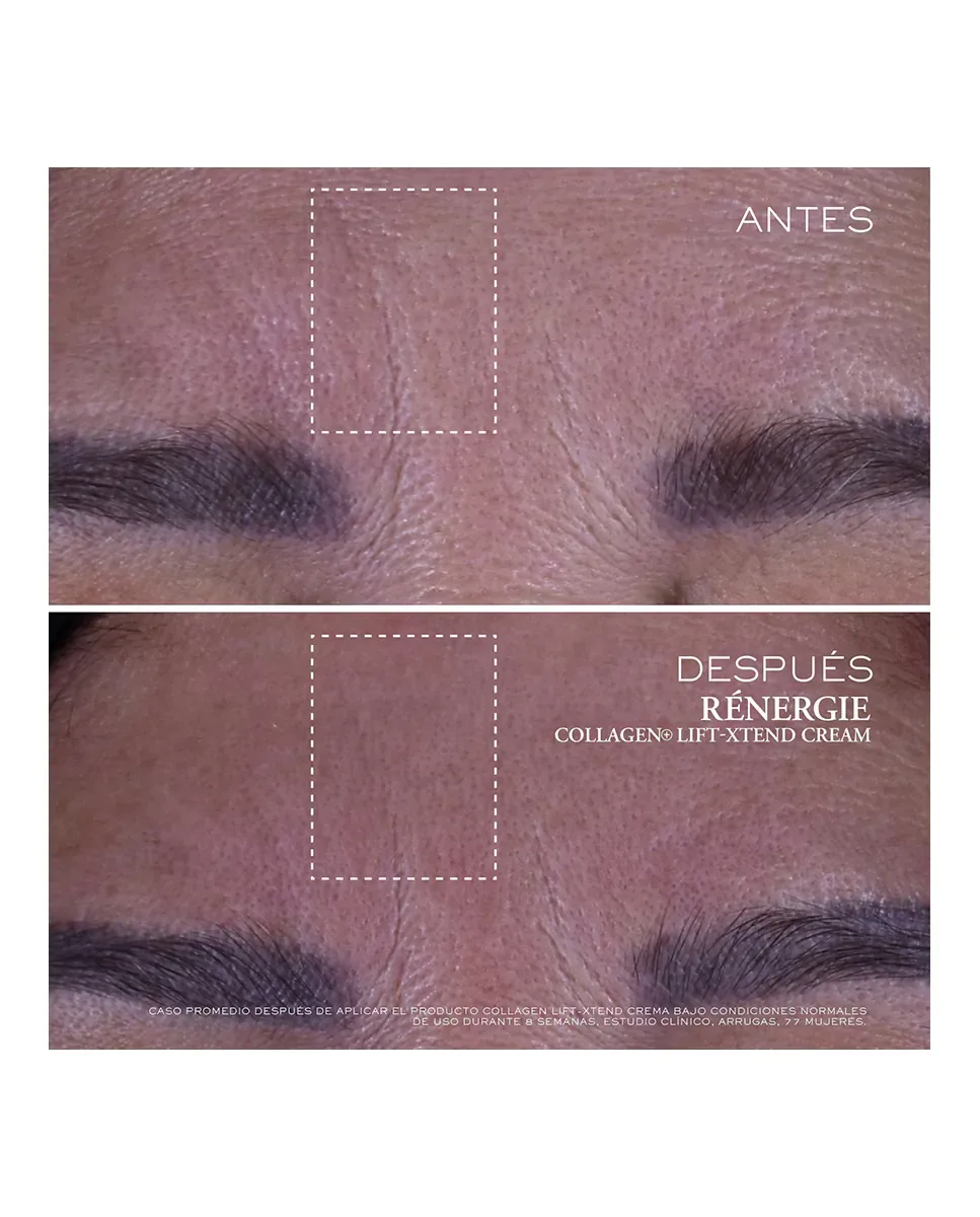 Крем для лица Lancôme — Rénergie Collage Lift-Xtend, 50 мл — фото 3