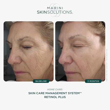 Лосьон Jan Marini Skin Research — Антивозрастной для лица Skinsolutions Retinol Plus с пептидами — фото 2