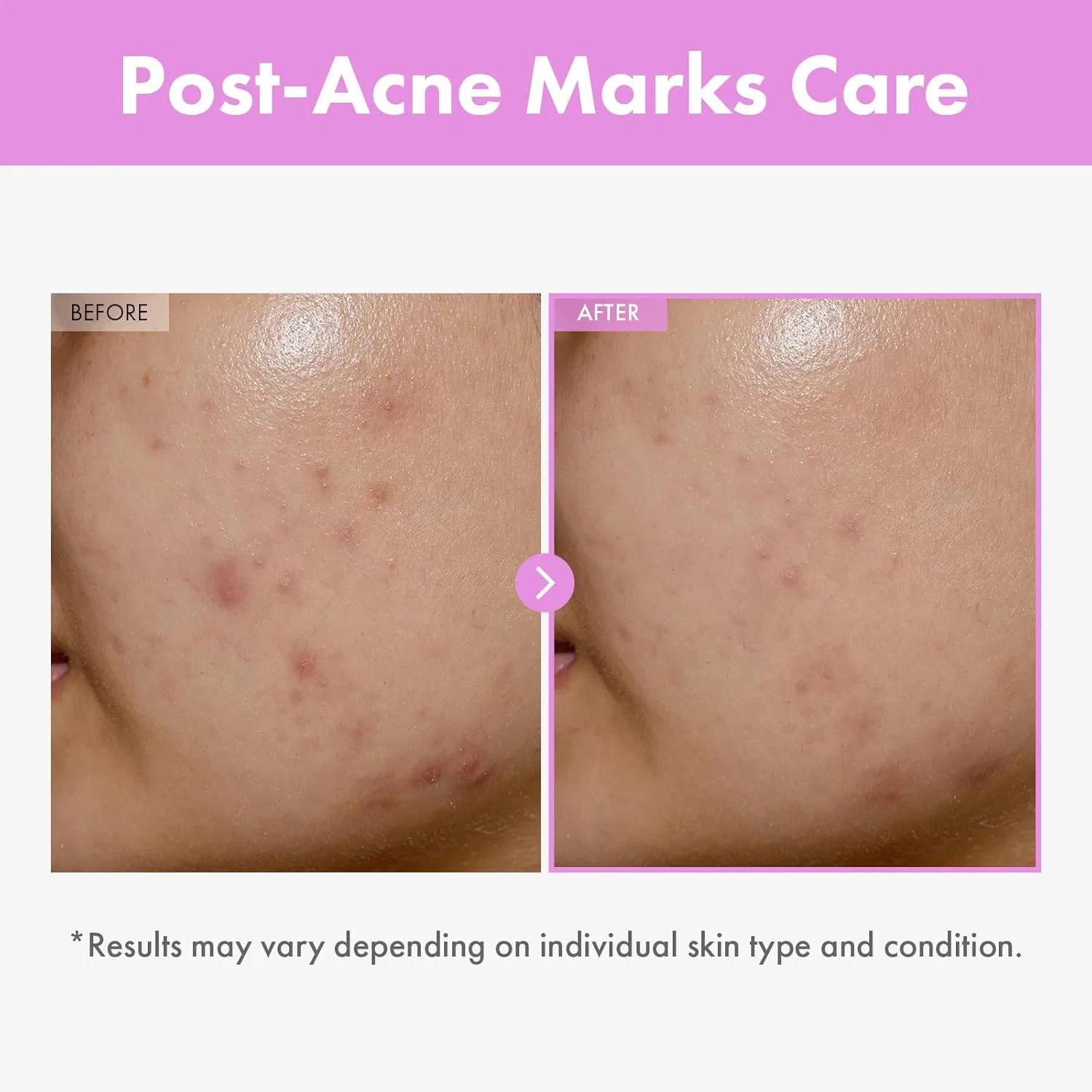 Тоник Tosowoong — Для лица «9 Peptide Skin Booster Serum» от, 150 мл — фото 3