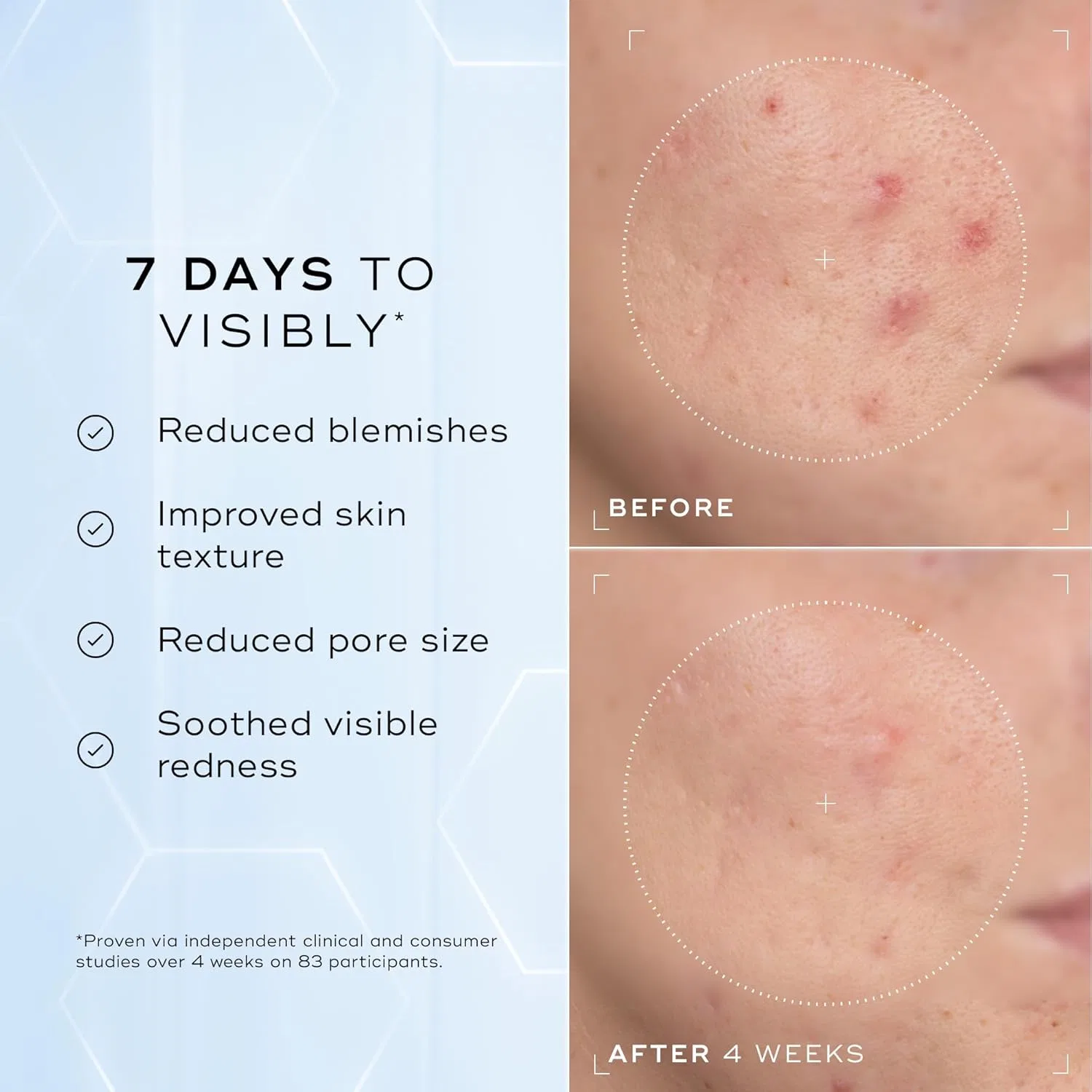 Сыворотка Medik8 — Балансирующая Niacinamide Peptides с % ниацинамида, пептидами и NAG, 30 мл — фото 2