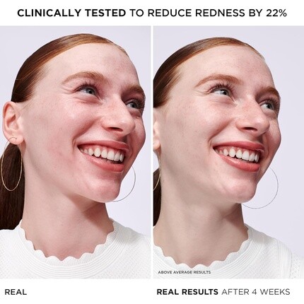 Сыворотка It Cosmetics — Bye Bye Redness Serum Успокаивающая кожу увлажняющая для лица 1 жидкая унция — фото 3