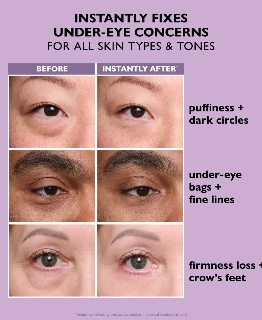 Peter Thomas Roth Временный крем для глаз Instant FIRMx Eye Temporary Eye Tightener, формула для легкого ношения, 20 мл — фото 3