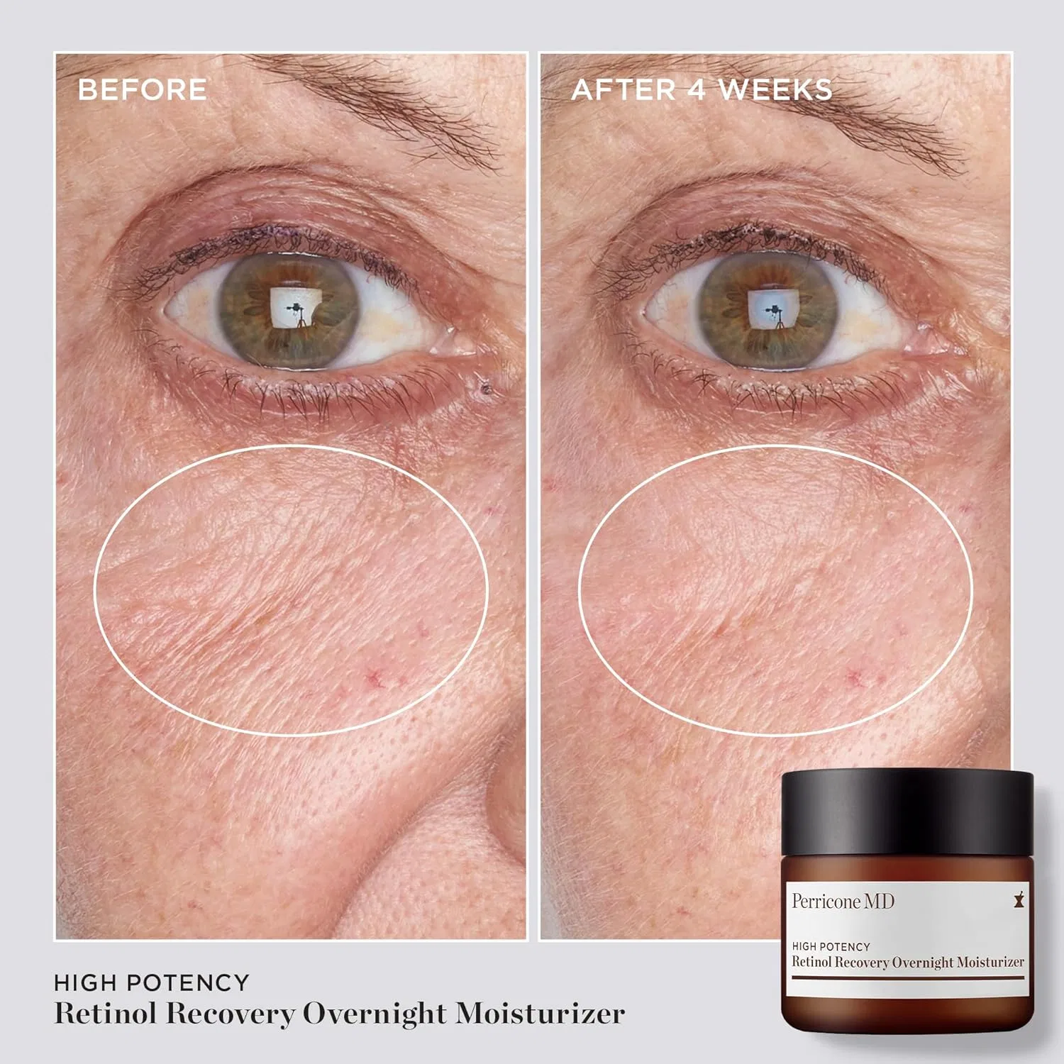Крем для лица Perricone Md — Ночной увлажняющий с ретинолом High Potency Retinol Recovery, 59 мл — фото 4