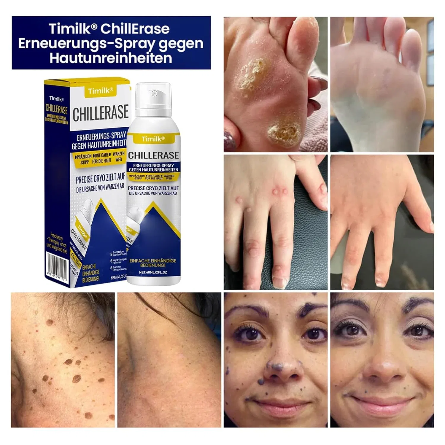 Спрей для обновления кожи «ChillErase Renewal Spray» от Timilk ‎Fummy, Pack Of 2 — фото 2
