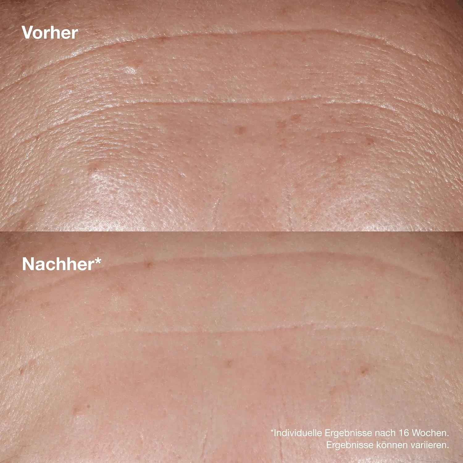 Сыворотка для лица Clinique Smart Clinical Repair с гиалуроновой кислотой Clinique — фото 4