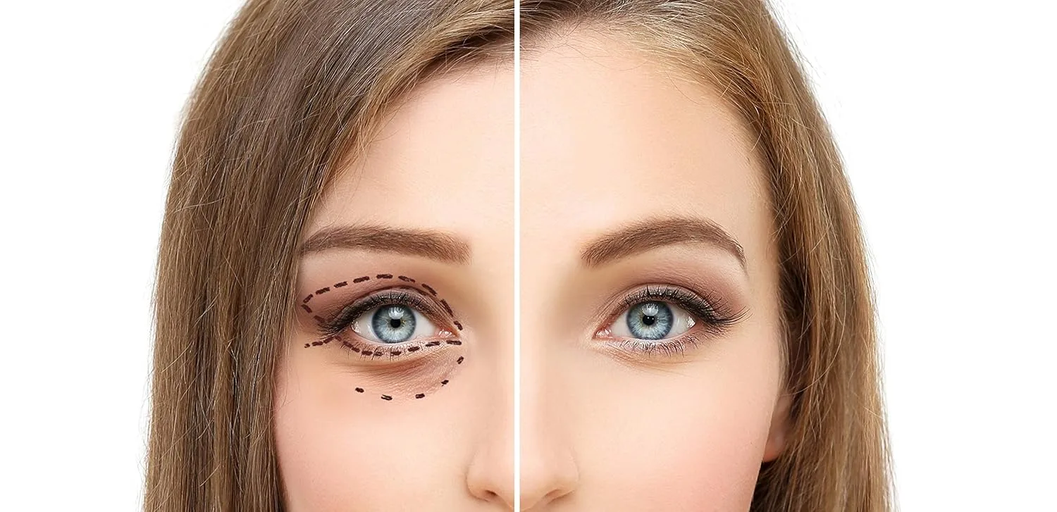 Osmotics Under Eye Rejuvenator, антивозрастной крем для глаз от темных кругов, мешков, морщин и отечности Osmotics Cosmeceuticals — фото 2