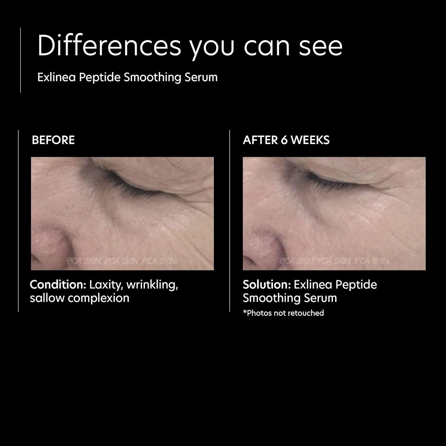 Набор PCA SKIN Vitamin C&E Advanced Brightening Treatment и сыворотка с гиалуроновой кислотой для борьбы с признаками старения — фото 4