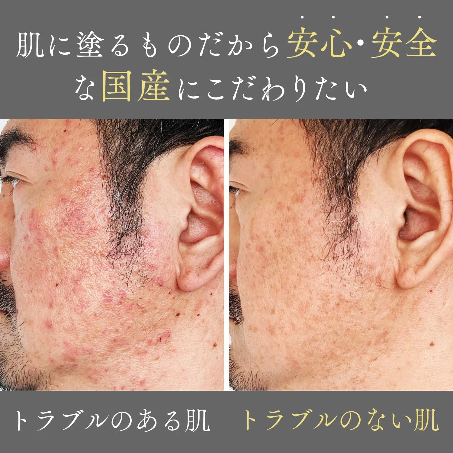 Крем для лица Goodskin Premium After Gel — Дневной с лошадиным маслом, 40 мл — фото 4