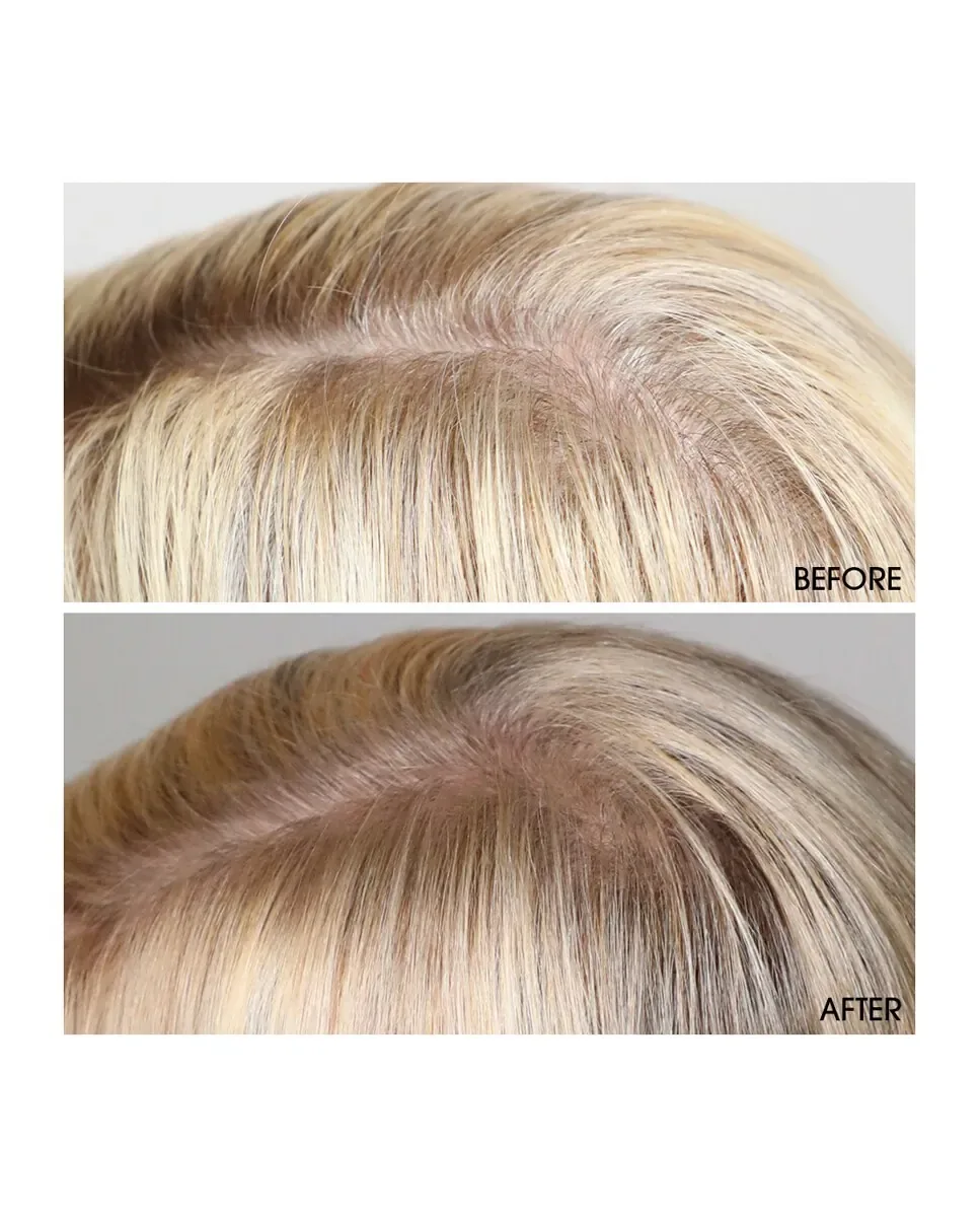 Сыворотка для активации роста волос Hair Activating Serum 120 мл M2 Beauté — фото 3