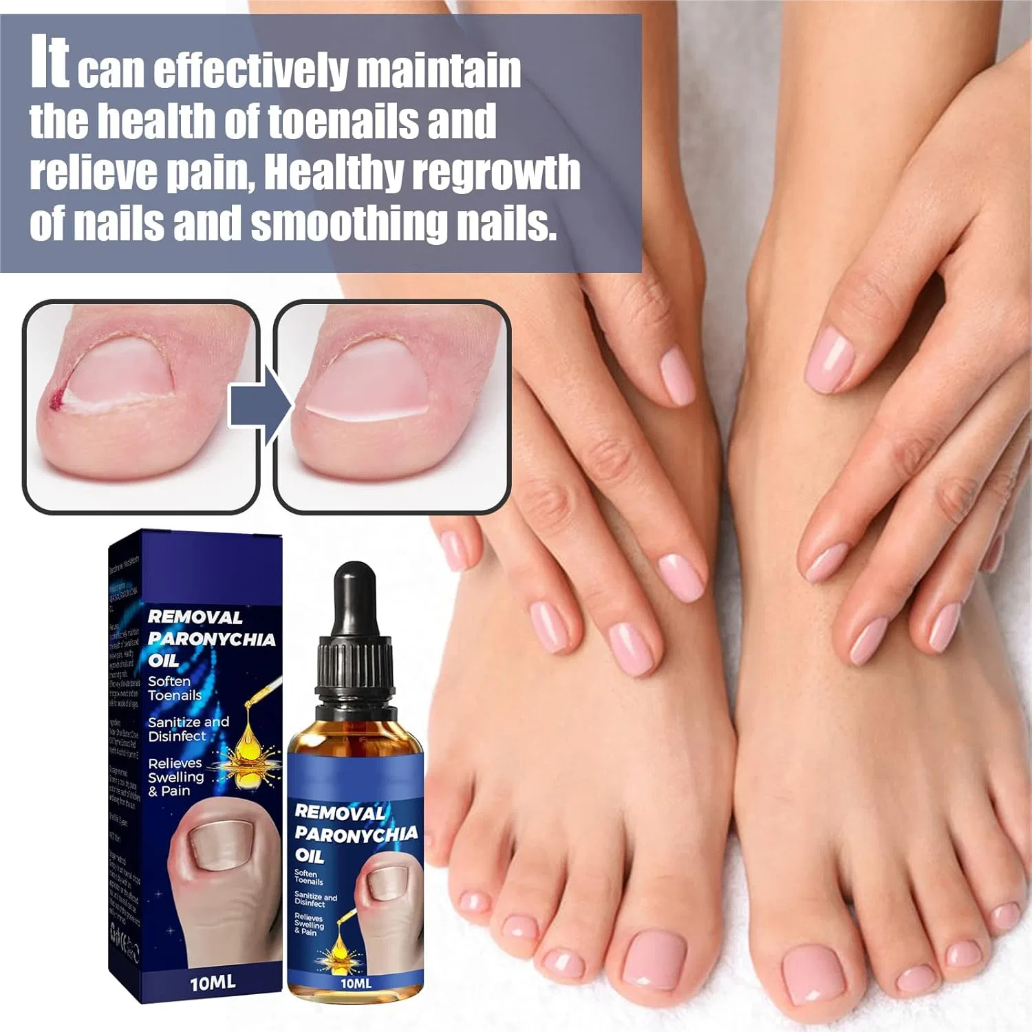 Масло German Toenailcare Removal Paronychia Oil для ухода за ногтями, 10 мл Sovtay, 1Pcs — фото 2