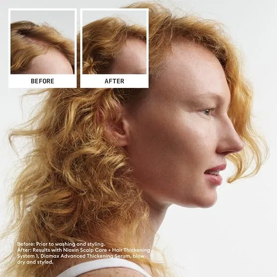 Набор NIOXIN Scalp + Hair Thickening System для натуральных, окрашенных и поврежденных волос с легким и прогрессирующим истончением, укрепляет и повышает густоту с ниацинамидом и биотином, запас на 1 месяц, 1 Month Supply | Trial Size — фото 3