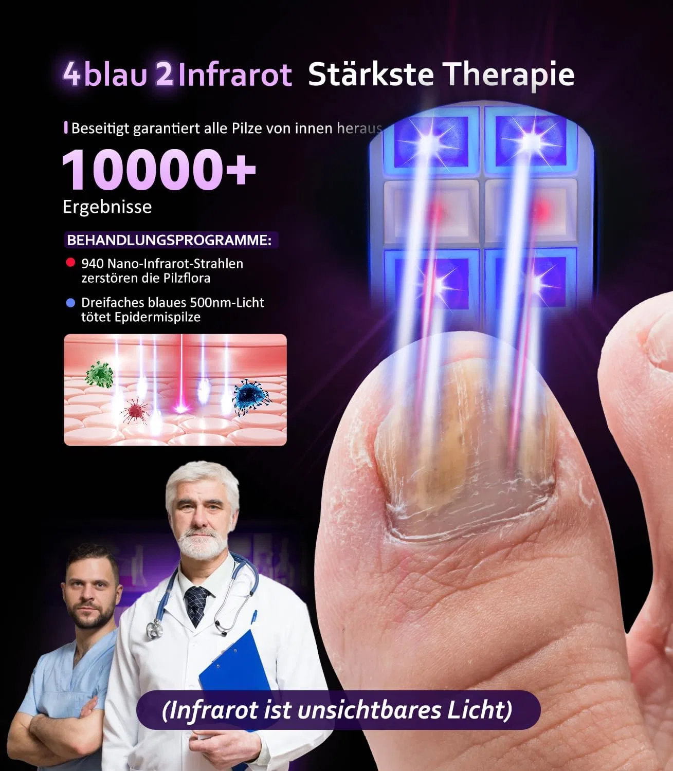 Лазерное устройство для лечения грибка ногтей 4.0 Quality Naelpilz Lozltx — фото 2
