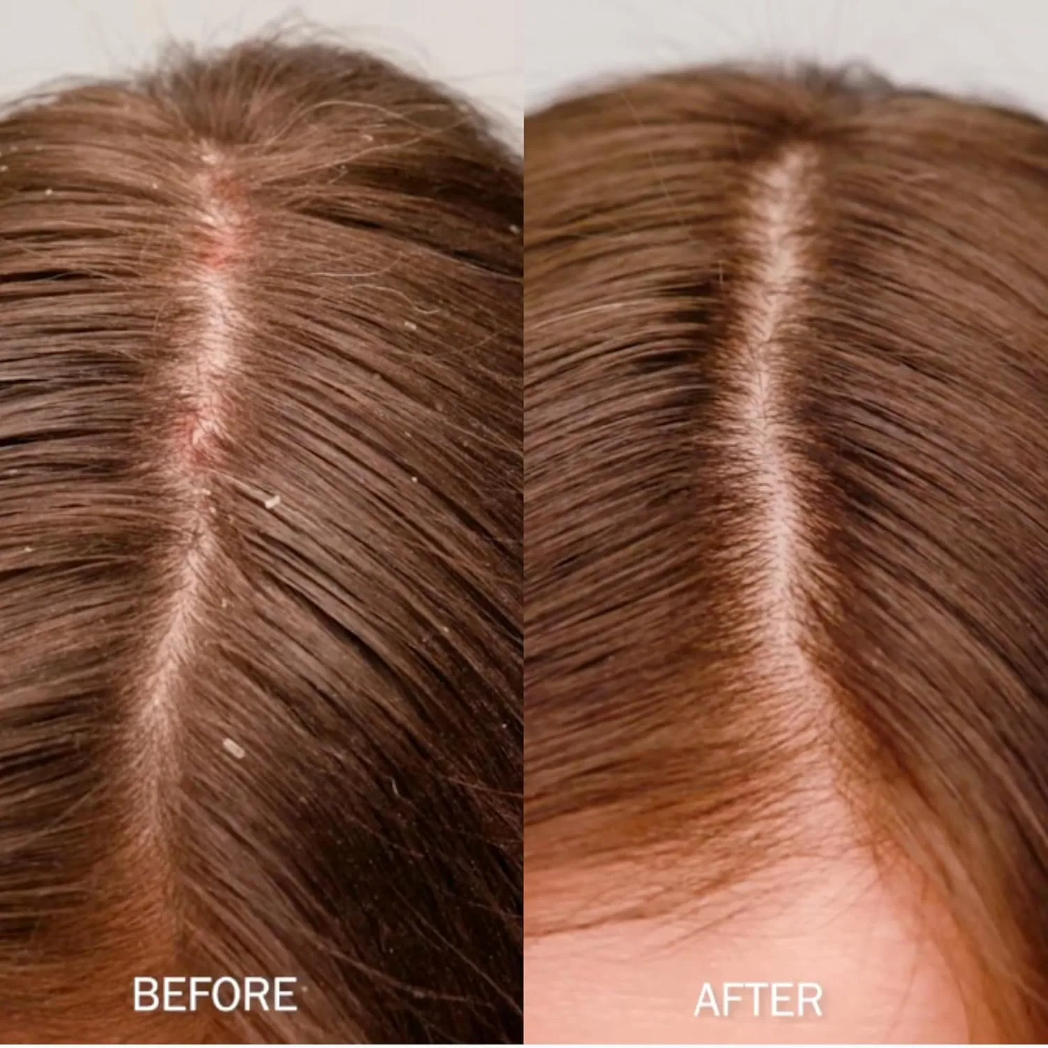 Шампунь для кожи головы «Scalp Shampoo» от SachaJuan — фото 2