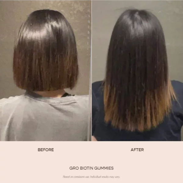 Набор сыворотки Gro Hair и жевательных конфет с биотином для истончения волос Vegamour — фото 3