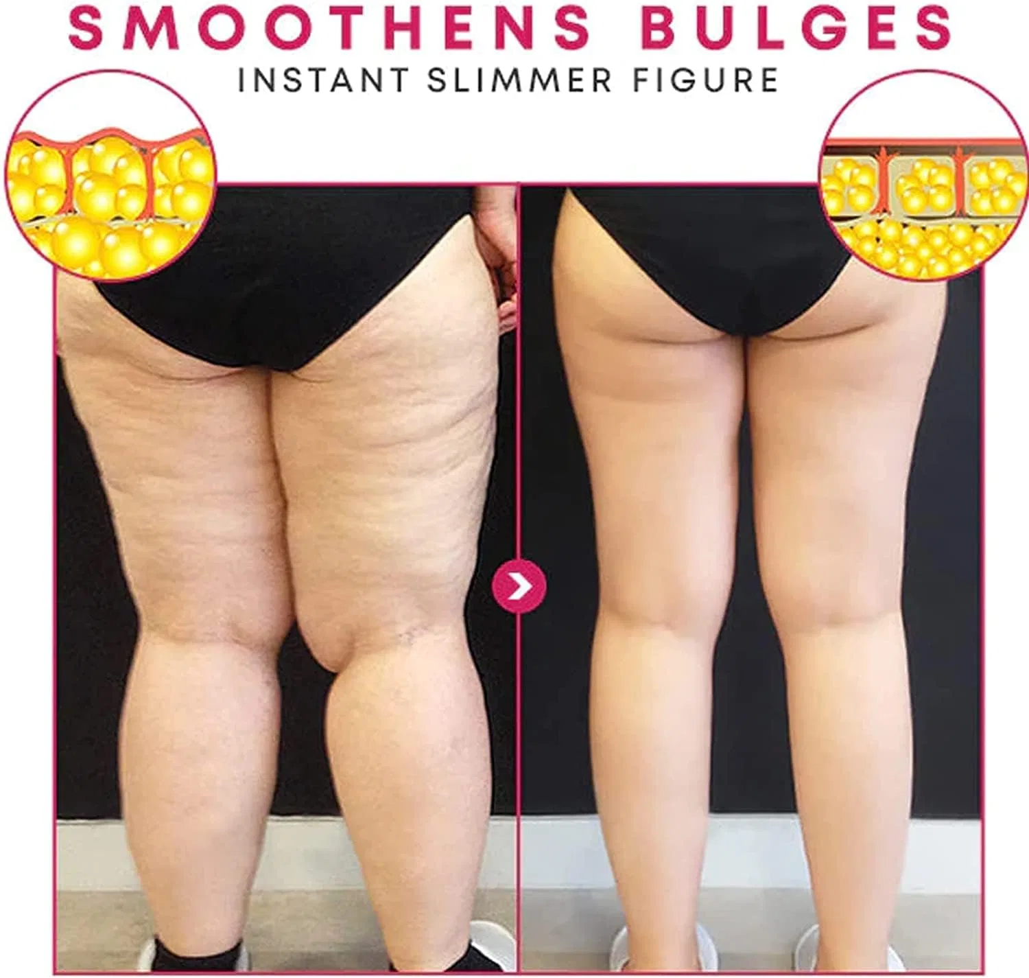 Антицеллюлитные патчи для бедер BodiFix Restore & Firm Thigh Wrap Pnedeodm, 300 Pieces. — фото 4
