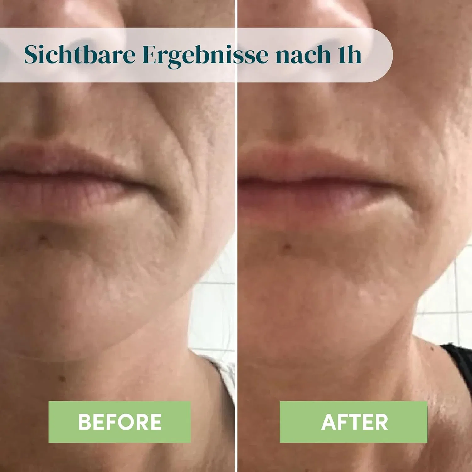Силиконовые патчи для рта от морщин с гиалуроновой кислотой от APRICOT Apricot Beauty & Healthcare — фото 4