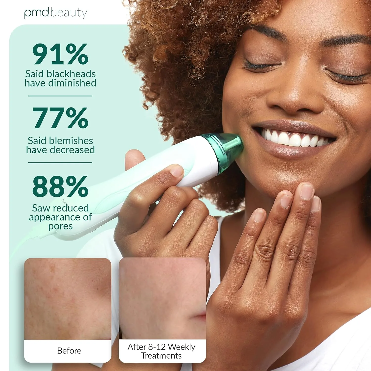 PMD Beauty Personal Microderm Pro - Инструмент для микродермабразии для домашнего использования, отшелушивающий скраб для лица и тела., Teal — фото 4