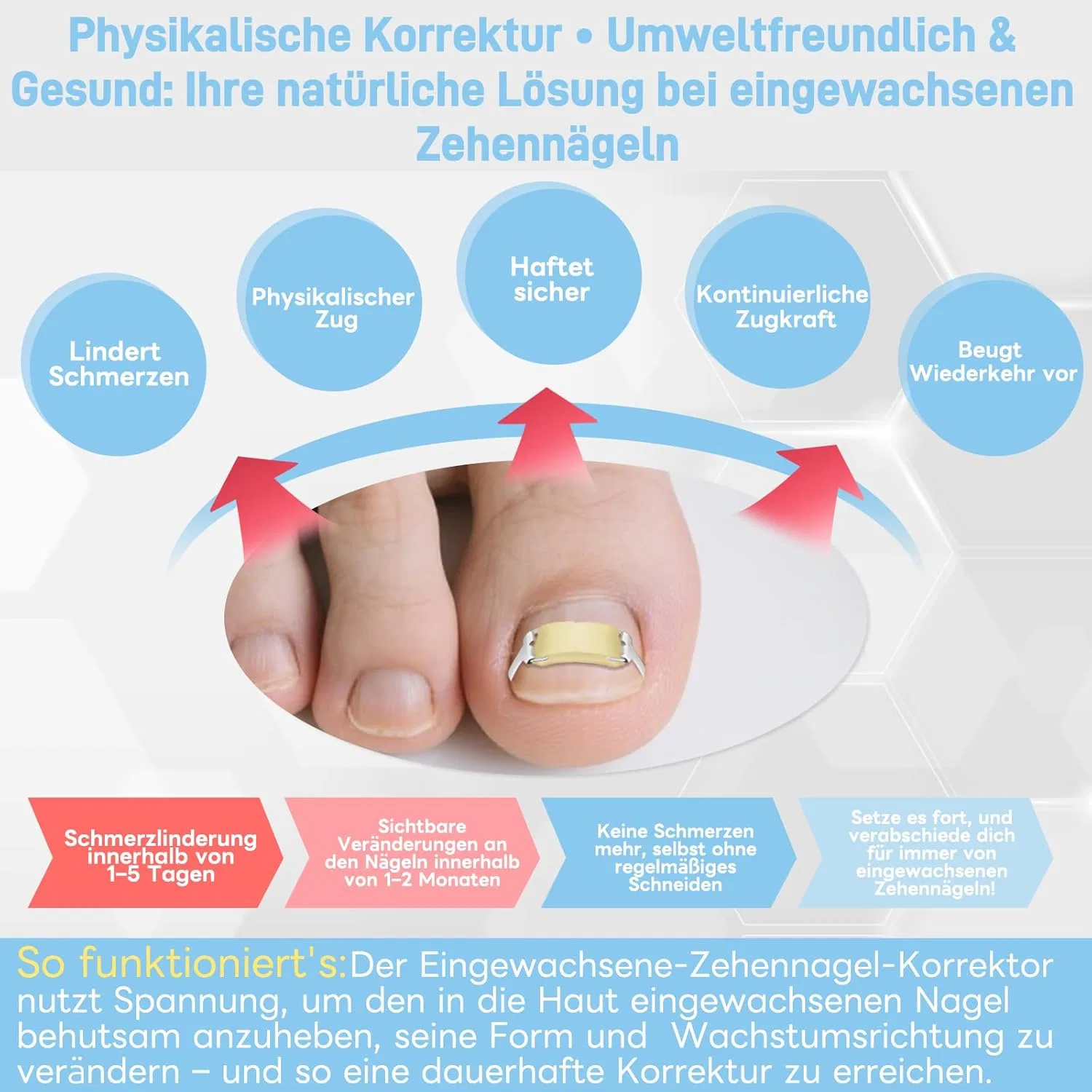 Корректор вросшего ногтя от Ingrown Toenail Correctionary Inhwrior — фото 2