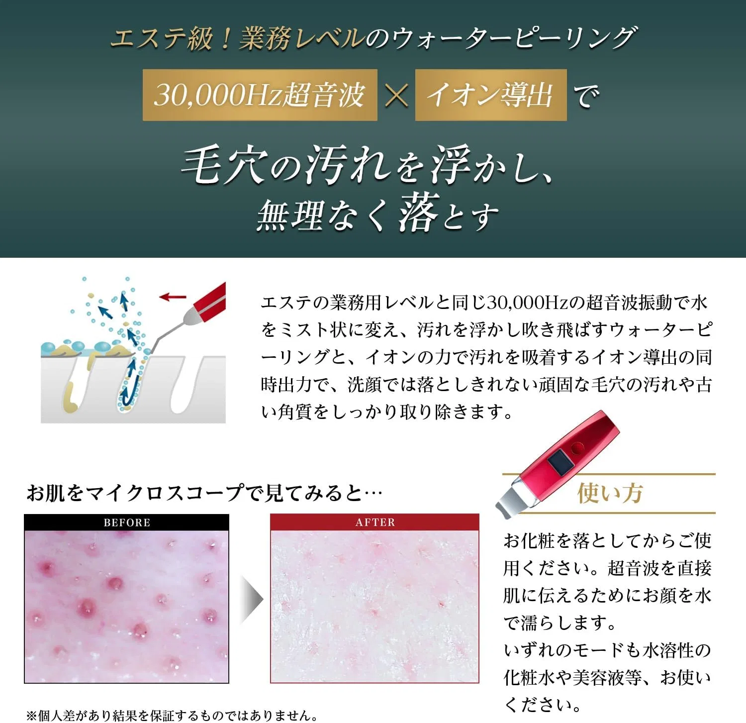 Ультразвуковой прибор для лица Aqua Lift-Peeling Roserine Dr.'S Esthetics — фото 3