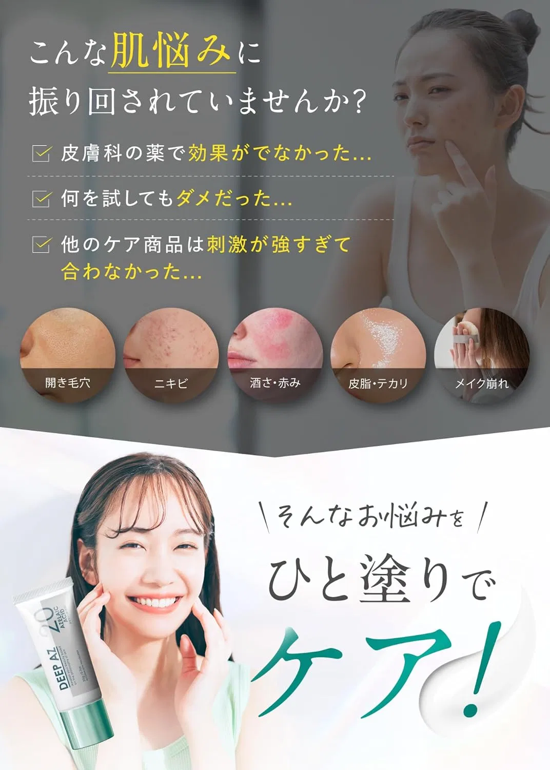 Набор Alyssum Skin Philosophy — Дневной крем с 20% азелаиновой кислотой , набор 3 шт. по 20 г — фото 3