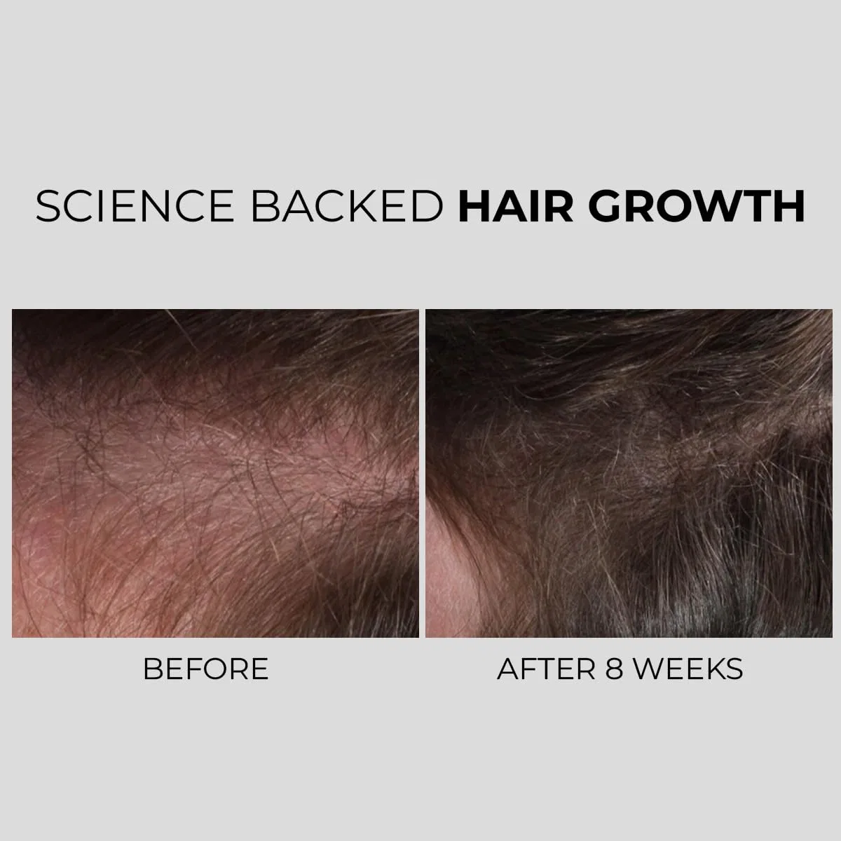 Сыворотка для роста волос Nanogen Hair Growth Factor Treatment Serum 30 мл Nanogen — фото 3