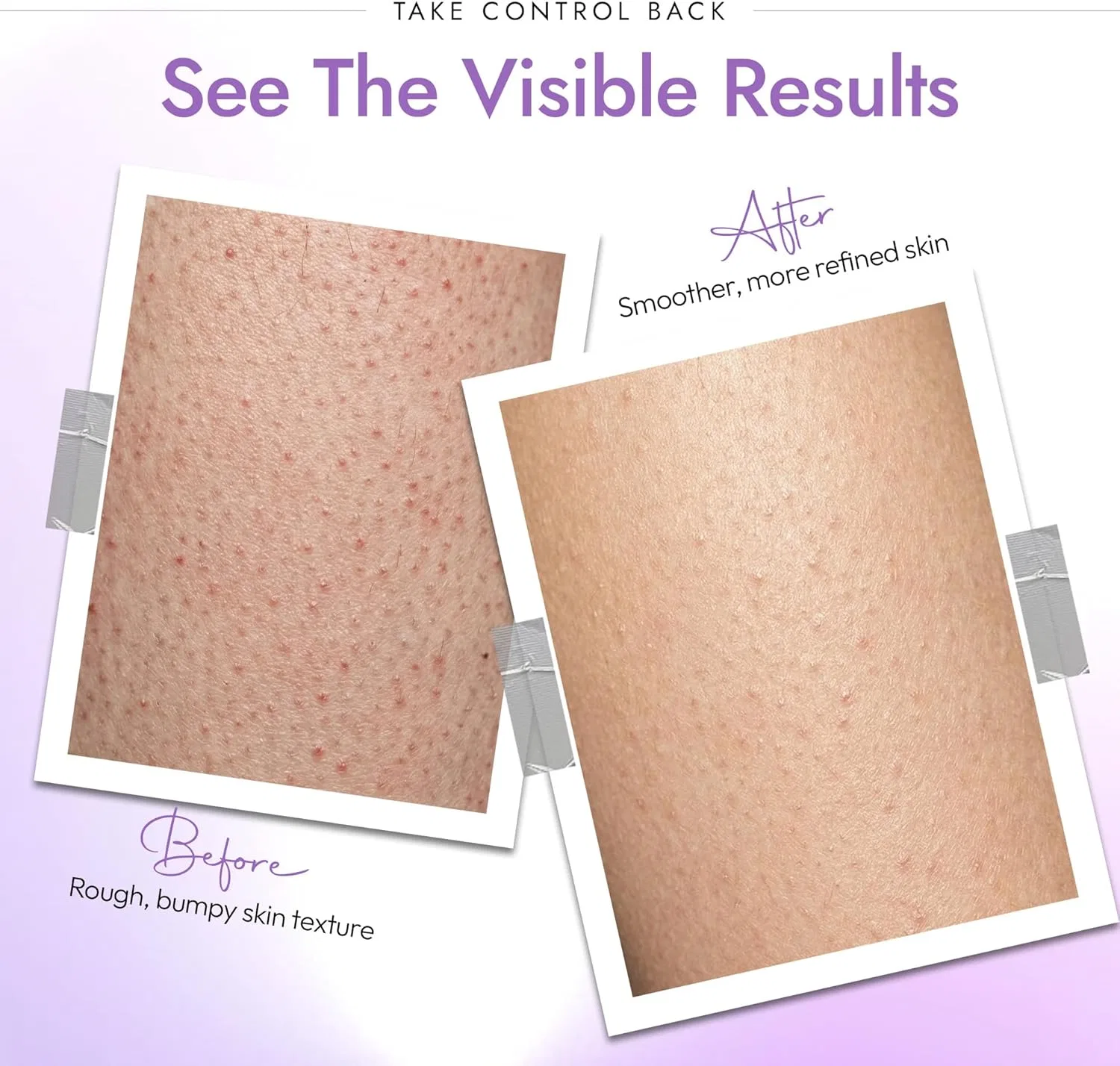 Скраб для тела Derma Doctor KP Duty Dermatologist Formula 16.7 унций — фото 3