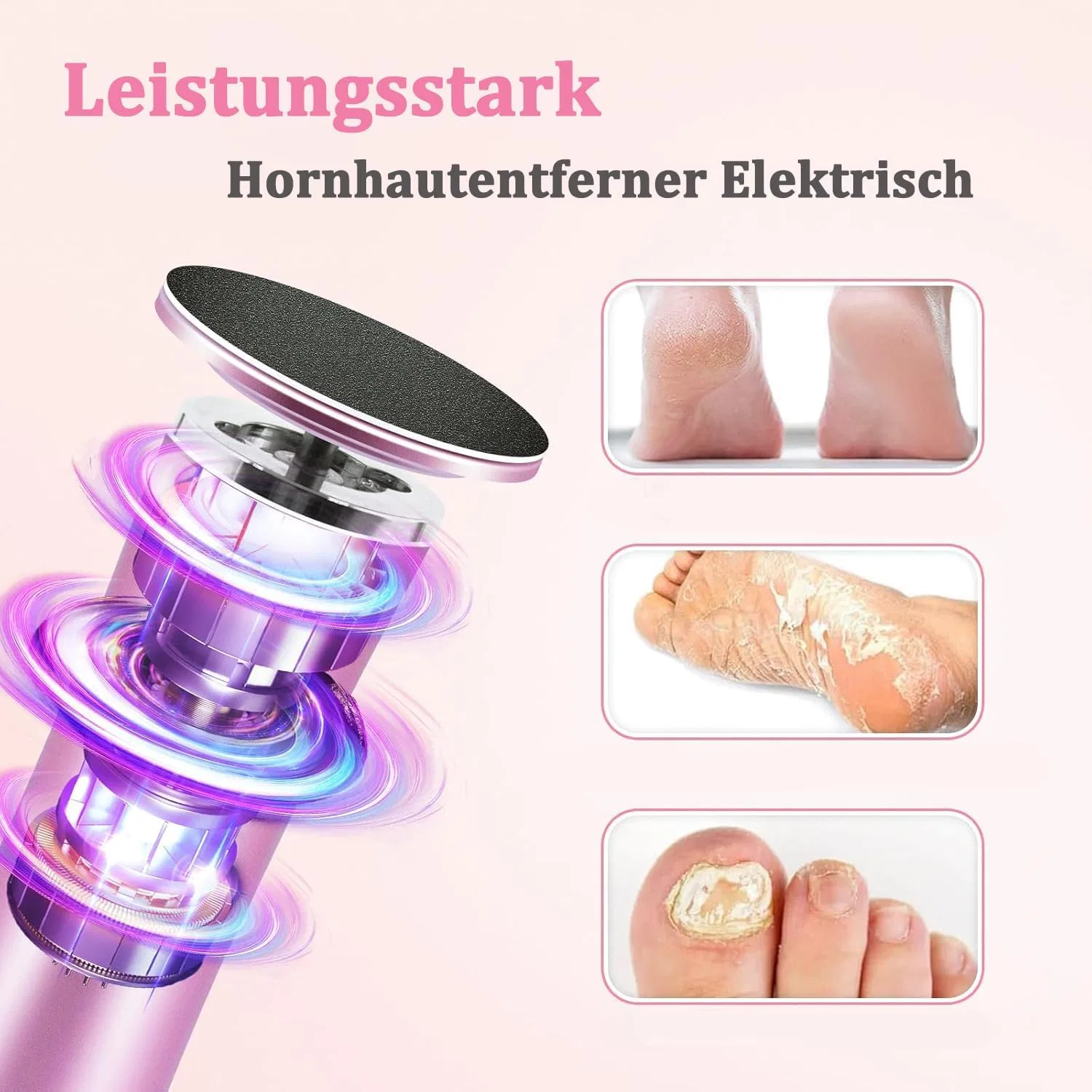 Электрическая пилка для удаления мозолей «DermaGlide Pro» от Dermaglide Hitianya, Pink — фото 2