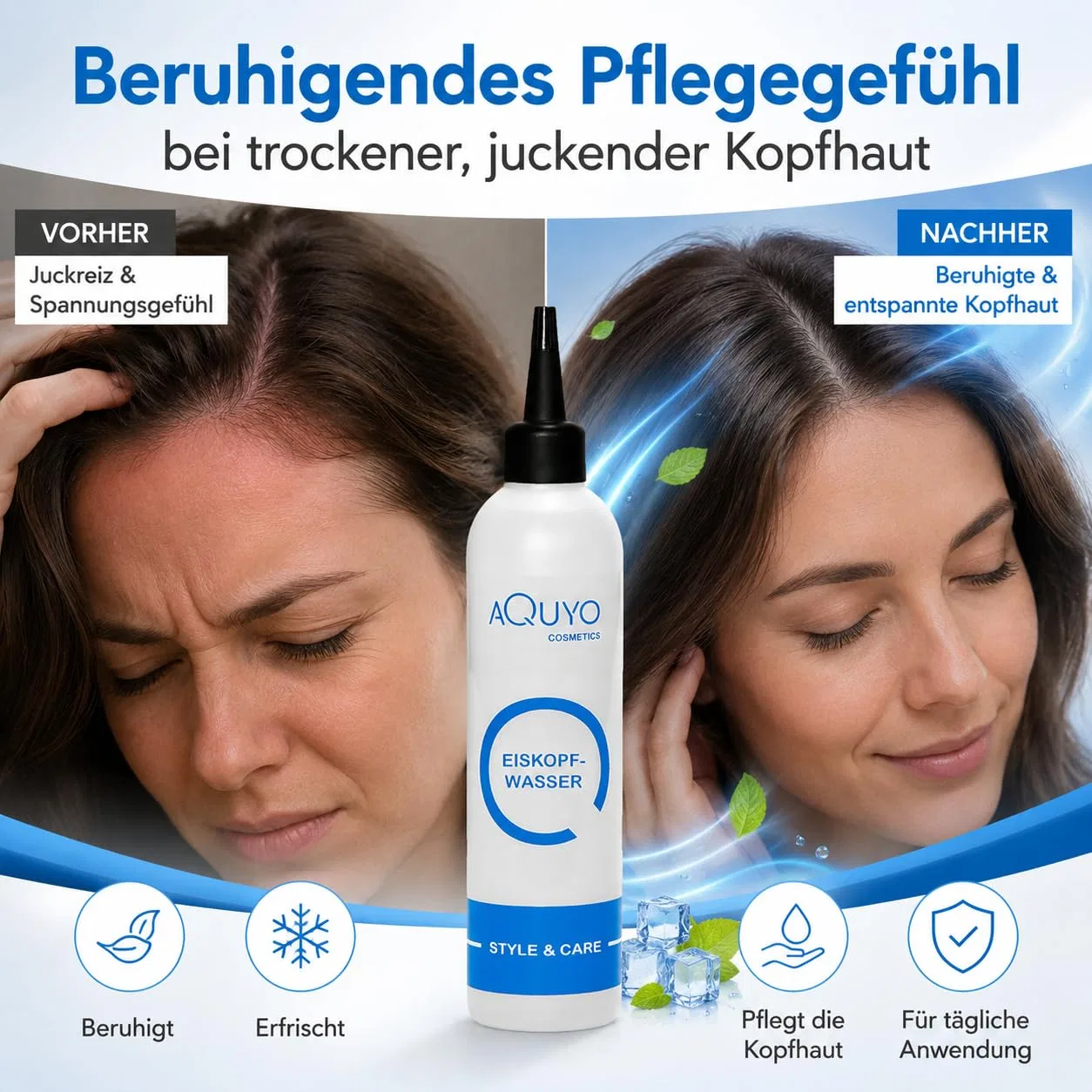 Охлаждающий тоник для кожи головы Ice Water Hair Water с ментолом ‎Aquyo Cosmetics — фото 3