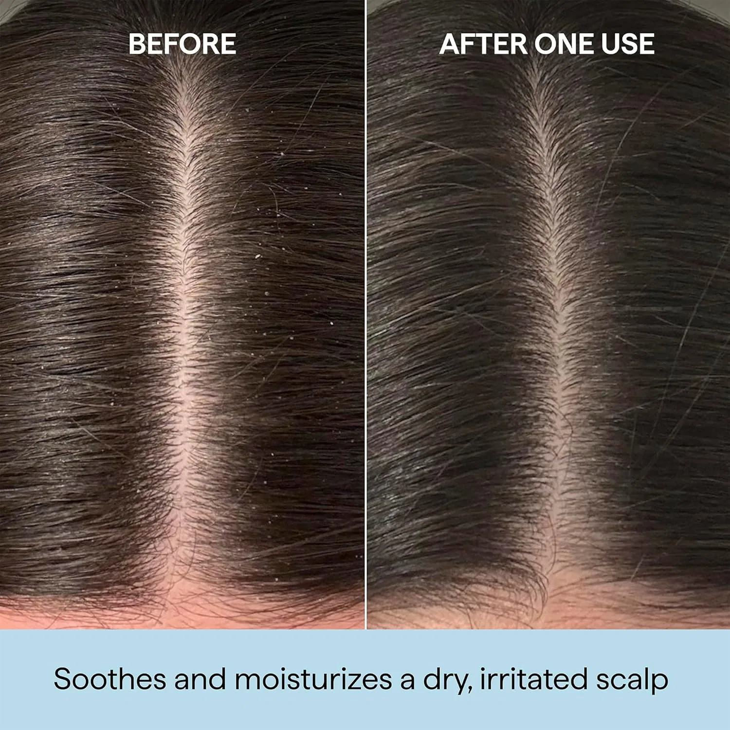 Масло для кожи головы Briogeo Scalp Revival Rosemary Prewash 100 мл Briogeo — фото 2