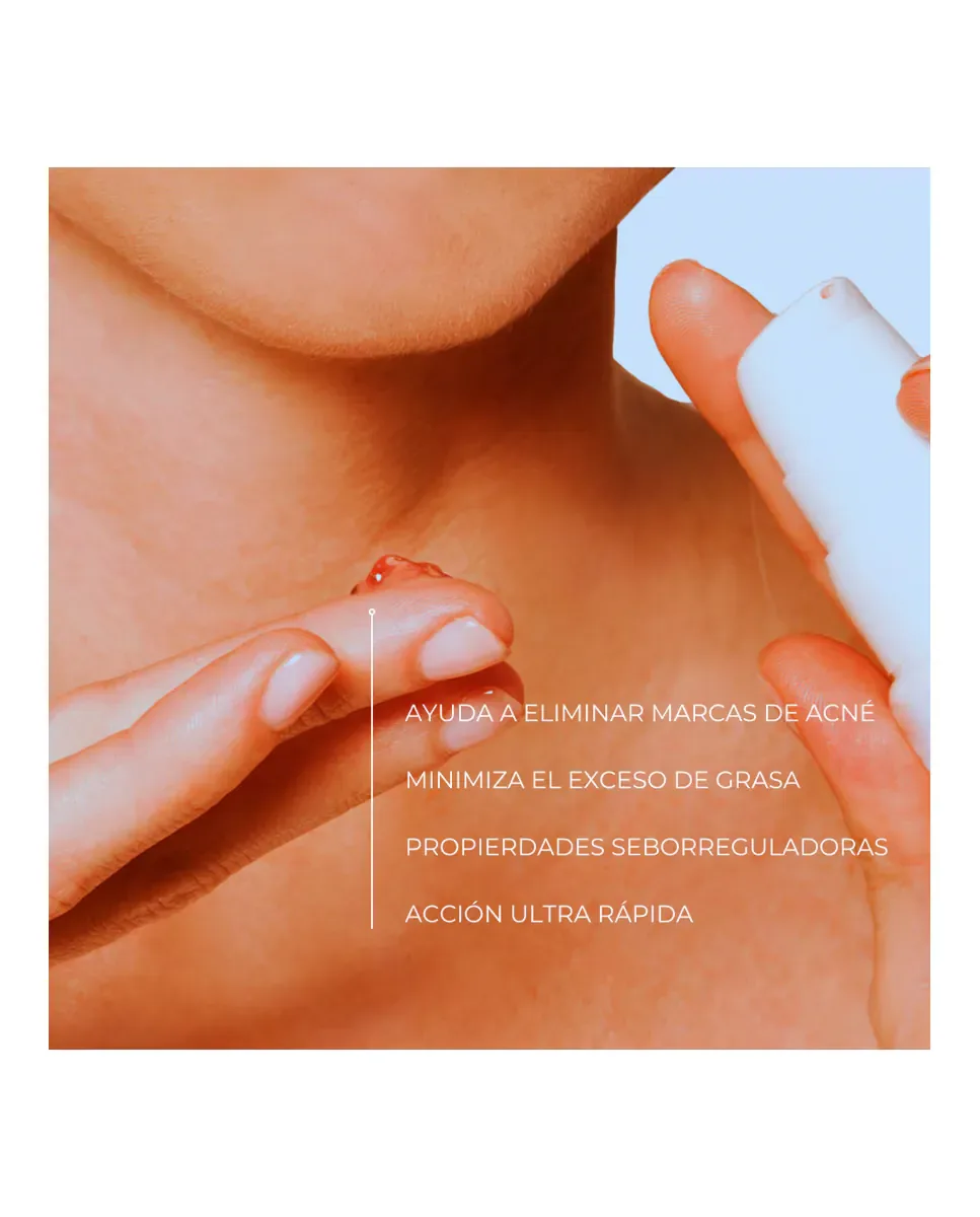 Гель для умывания Farma Dorsch — Увлажняющий себорегулирующий гель Stop Akneik фарма, 50 мл — фото 2