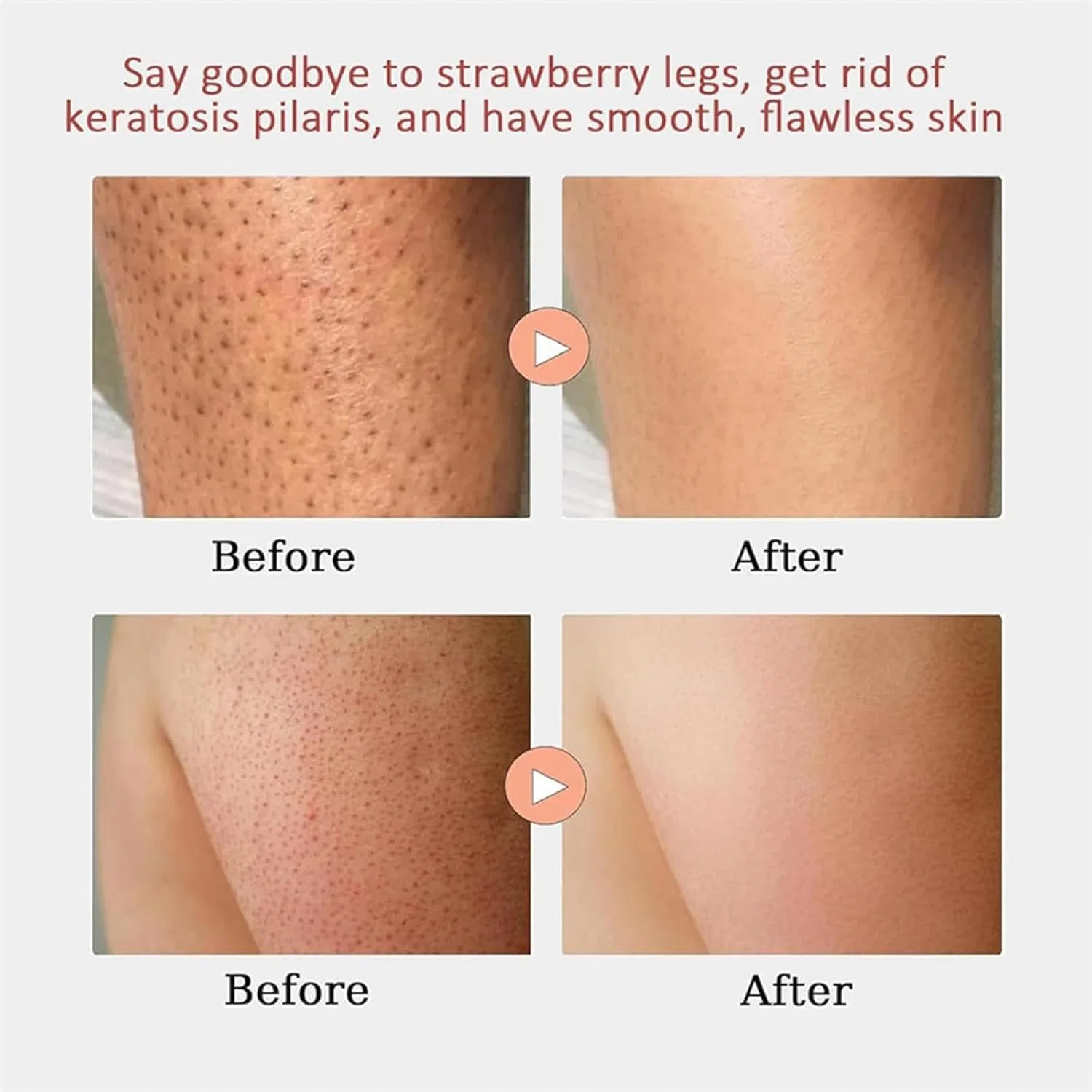 Крем Strawberry Skin Resurfacing Cream для ног с клубничной кожей Generisch — фото 3