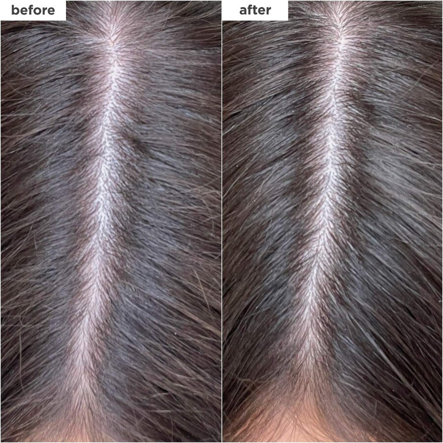 Сухой шампунь Scalp Revival с углем и биотином Briogeo, 1.7 oz/50 mL — фото 3