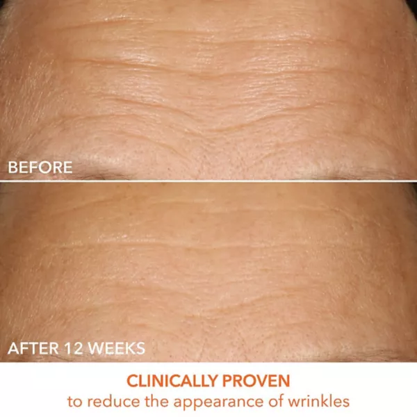 Сыворотка Dr. Dennis Gross Skincare — Витамин С молочный % для упругости и яркости — фото 3