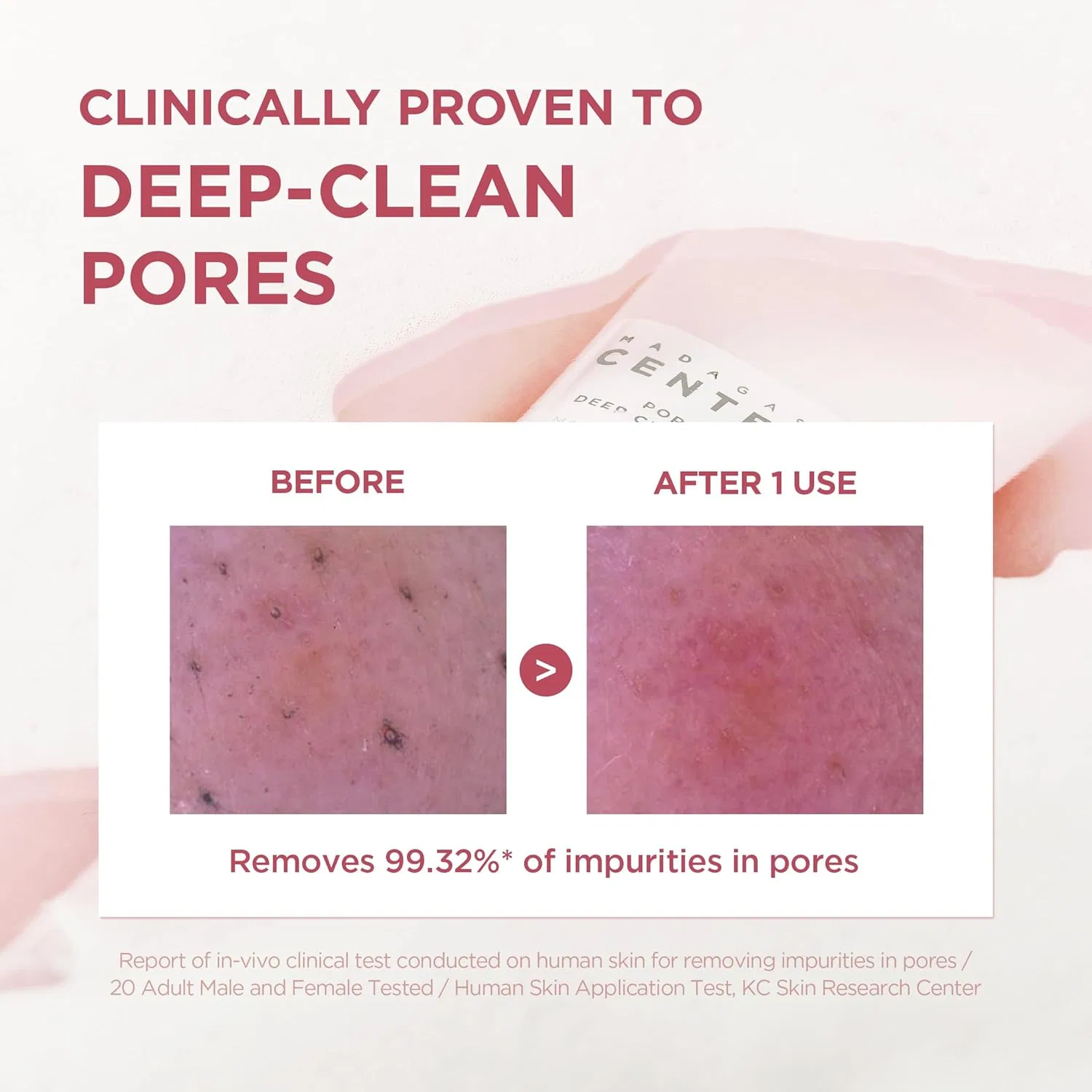 Пенка для умывания SKIN1004 — Poremizing Deep Cleansing Foam, 125 мл — фото 3